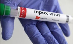 İngiltere’de mpox virüsünün yeni bir türü tespit edildi