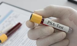 Üroloji Uzmanı Ataman: Prostat kanseri çoğu zaman belirti vermeden ilerler