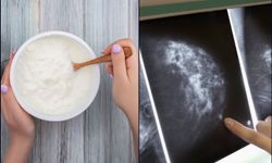 Yoğurt tüketimi meme kanserine karşı koruyucu olabilir mi?