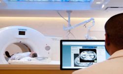 DSÖ: Dünya genelindeki kanser vakalarının 4'te 1'i önlenebilir