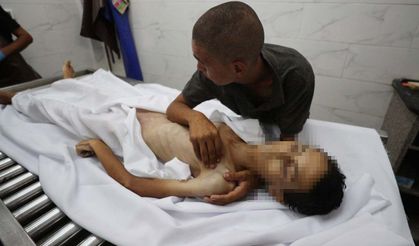 Siyonist rejimin Gazze'de on yıllardır süren "gıda silahı" politikası