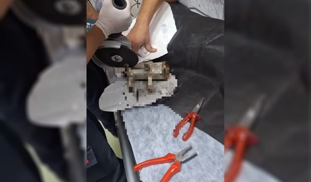 Şanlıurfa’da küçük Sara’nın eli kıyma makinesinden kurtarıldı