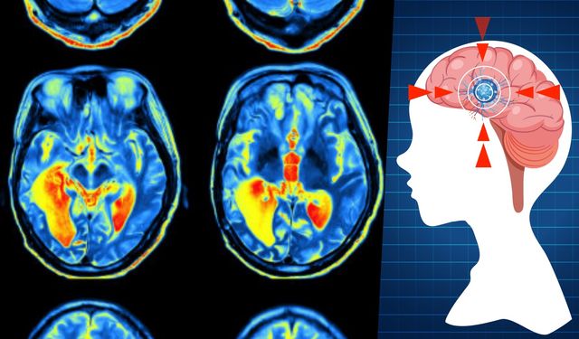 Bilim insanları beynin beş yaşam evresini belirledi: Kritik dönüm noktaları 9, 32, 66 ve 83 yaşında