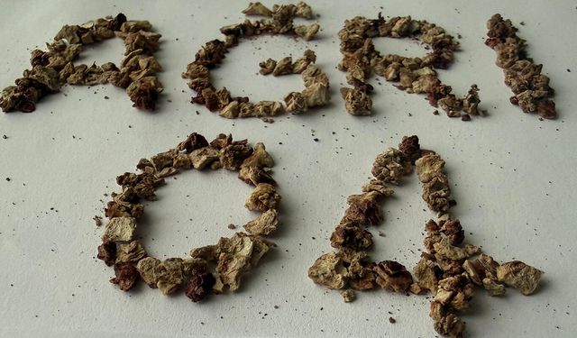 Ağrı'da gerçekleştirilen ameliyatta 295 taş başarıyla çıkarıldı